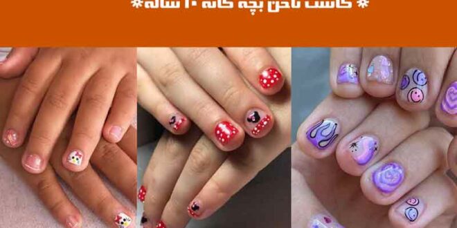 کاشت ناخن بچه گانه ۱۰ ساله